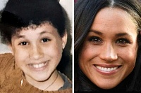 Click image for larger version. 

Name:	meghan-markle-plastic-surgery-4.jpg 
Views:	30 
Size:	31.0 KB 
ID:	14498