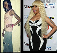 Click image for larger version. 

Name:	nicki minaj before and after surgery - Google Search.png 
Views:	118 
Size:	436.6 KB 
ID:	17806