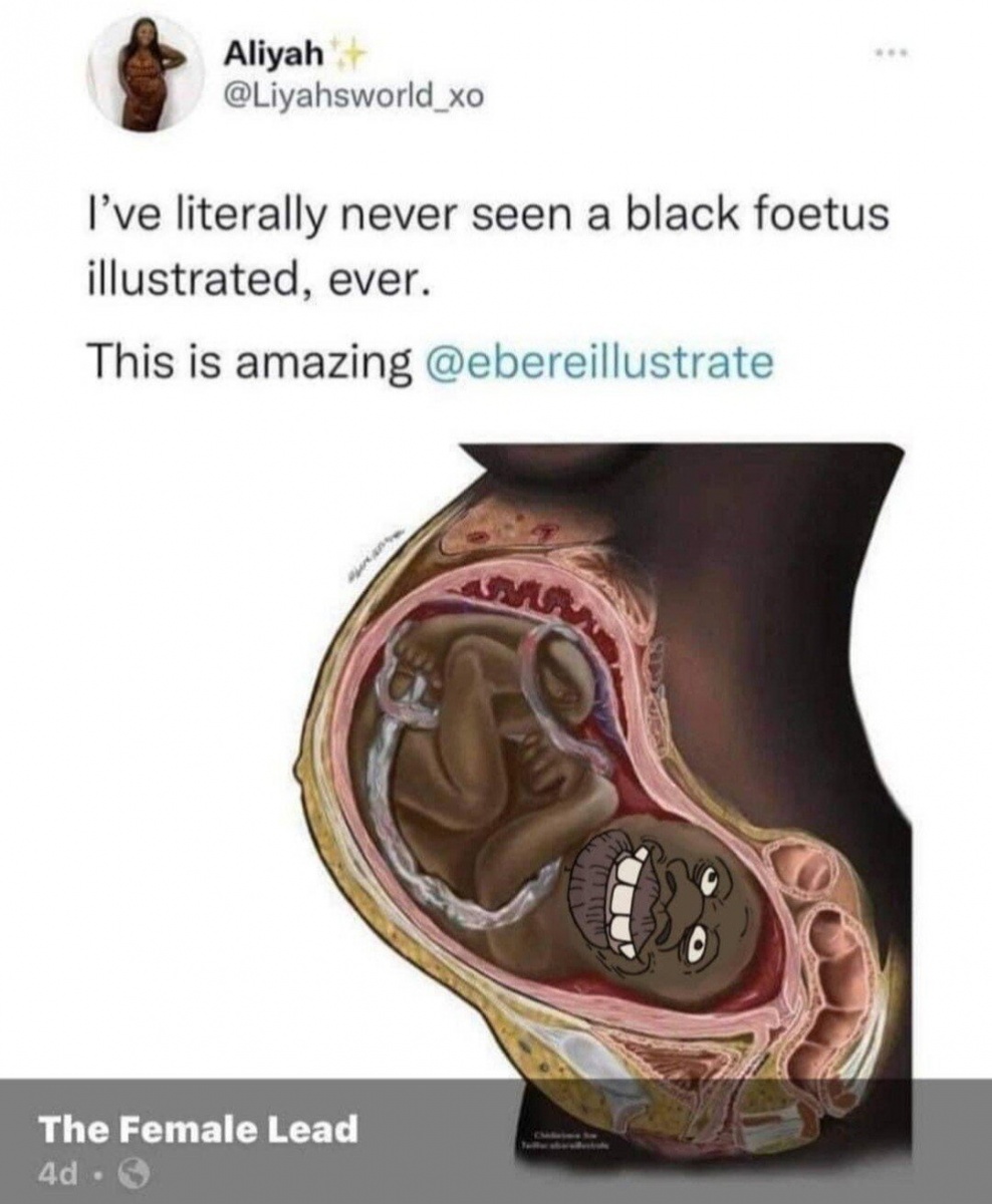 Name:  black fetus illustrated tyrone nigger 47098d010038fe07.jpg
Views: 1381
Size:  207.7 KB