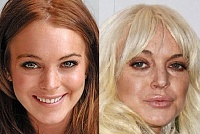 Click image for larger version. 

Name:	lindsay-lohan-plastic-surgery-after-3.jpg 
Views:	76 
Size:	48.2 KB 
ID:	9531